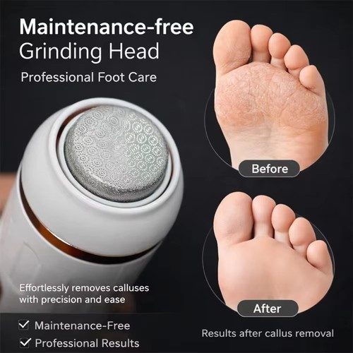 Rechargeable electric feet - rechargeable,