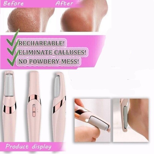 Feet callus remover electric - callus,