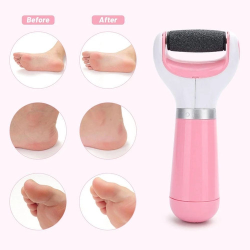 Rechargeable electric foot - electric,