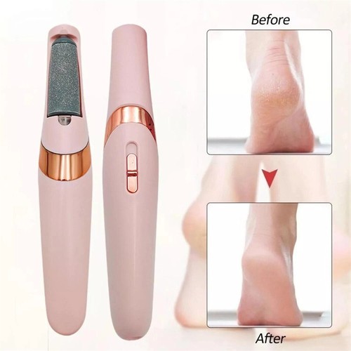 Feet callus remover - uk,